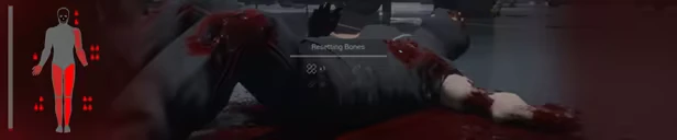 Obscurity: A soldier lies injured on the ground, with a "Resetting Bones" progress bar above.